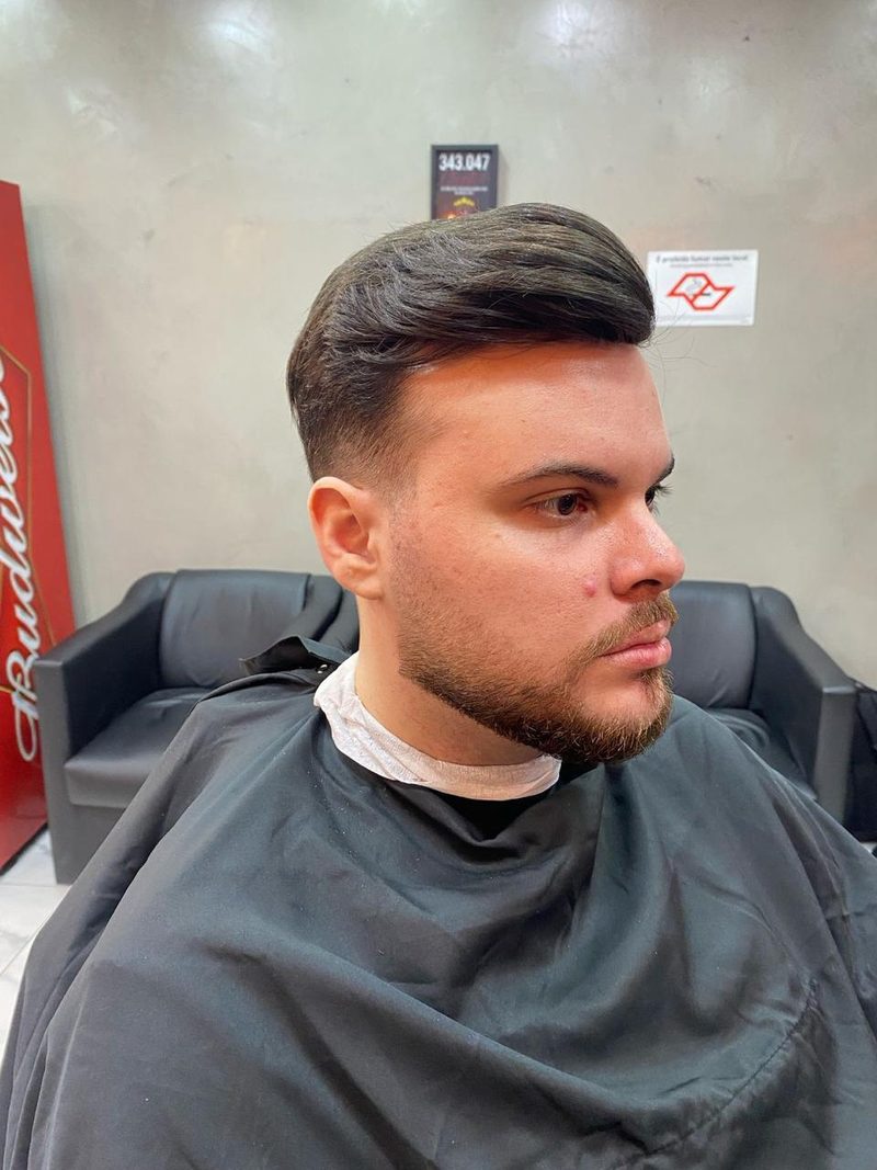 Cliente depois da prótese capilar, vista lateral