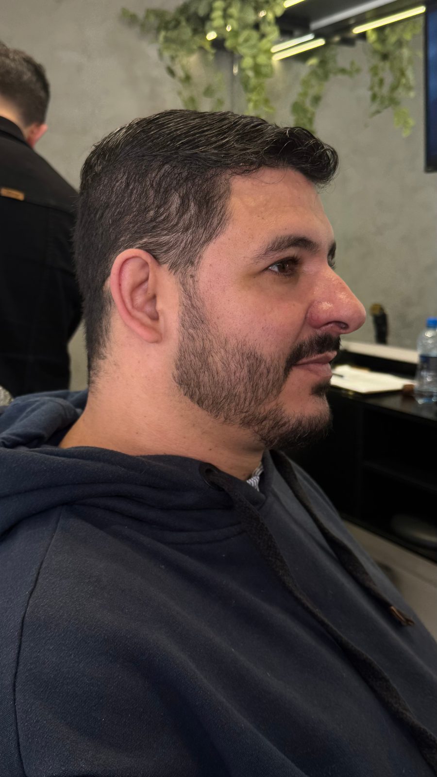 Cliente 1 antes da nanopigmentação, barba com falhas
