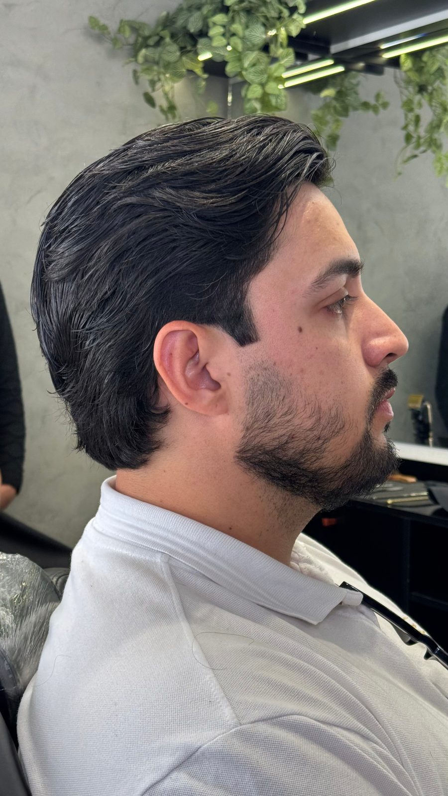 Cliente 2 antes da nanopigmentação, barba rala na bochecha